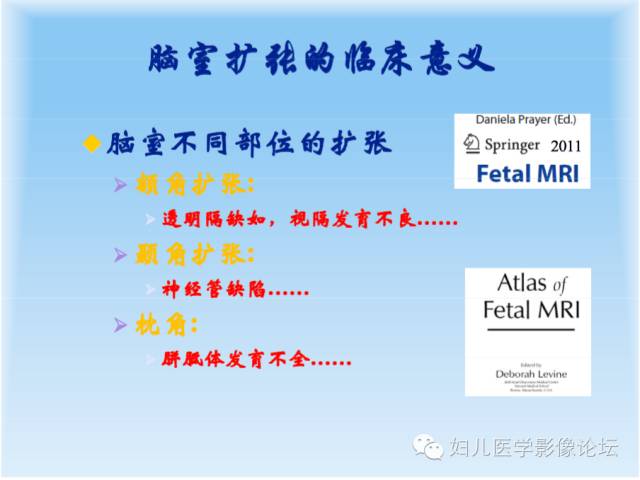 【PPT】胎儿颅脑常见先天异常MRI诊断