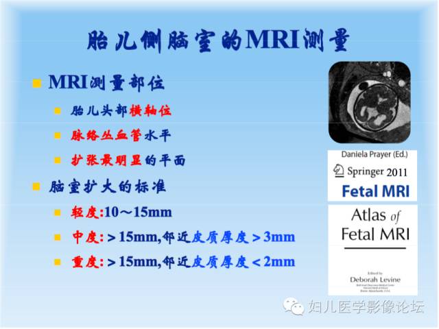 【PPT】胎儿颅脑常见先天异常MRI诊断