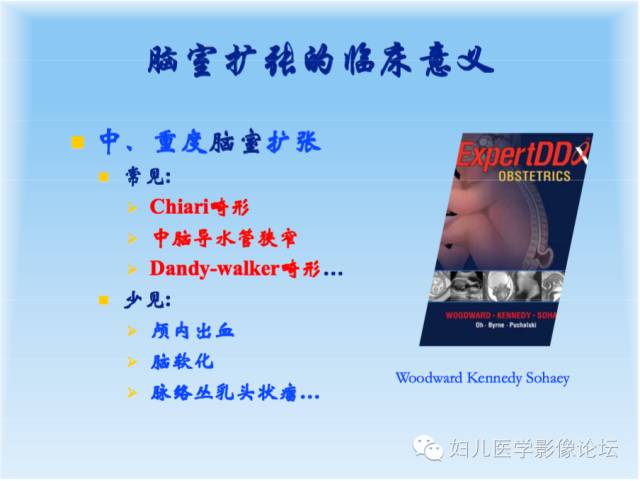 【PPT】胎儿颅脑常见先天异常MRI诊断