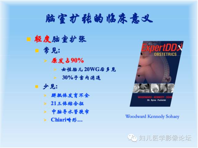 【PPT】胎儿颅脑常见先天异常MRI诊断