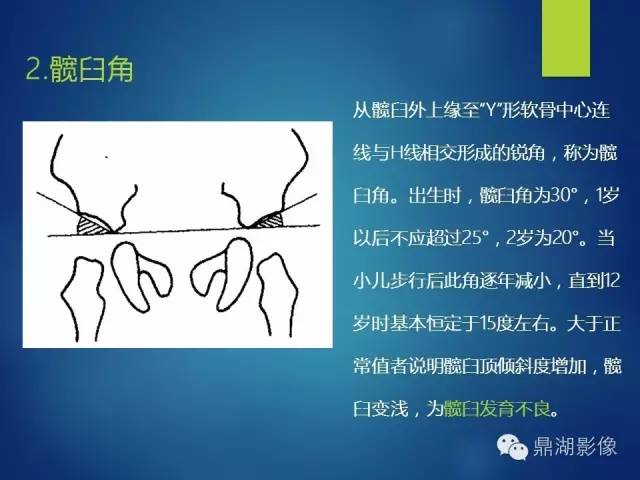 【PPT】骨盆的X线解剖