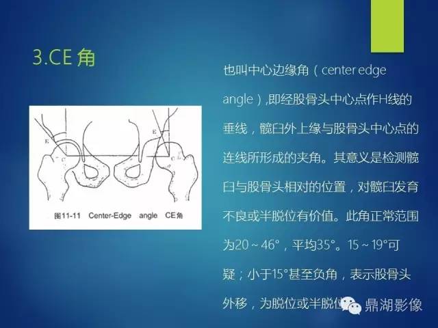【PPT】骨盆的X线解剖