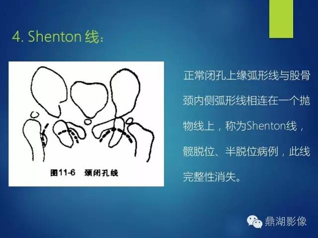 【PPT】骨盆的X线解剖