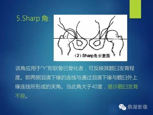 【PPT】骨盆的X线解剖