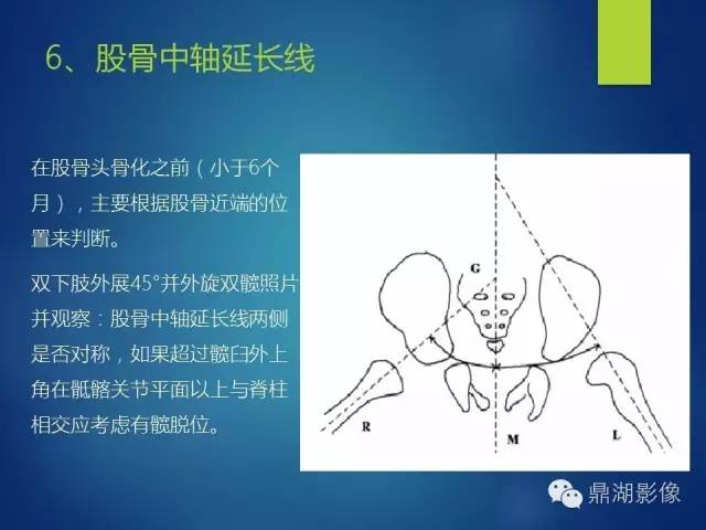 【PPT】骨盆的X线解剖