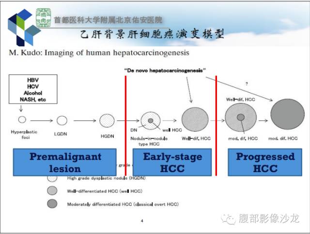 【PPT】HBV相关肝细胞癌演变MRI分级诊断