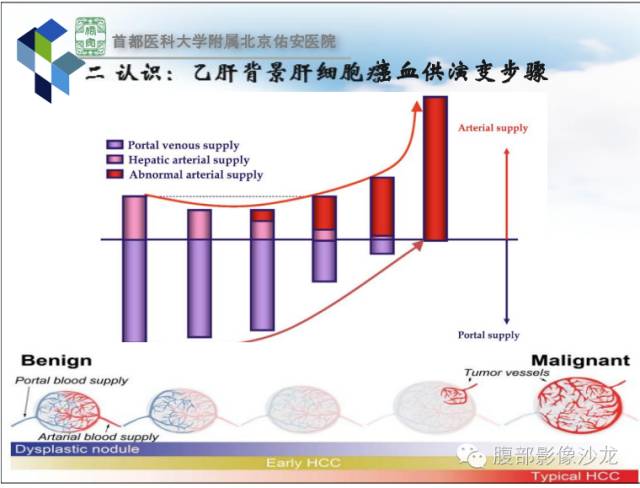 【PPT】HBV相关肝细胞癌演变MRI分级诊断