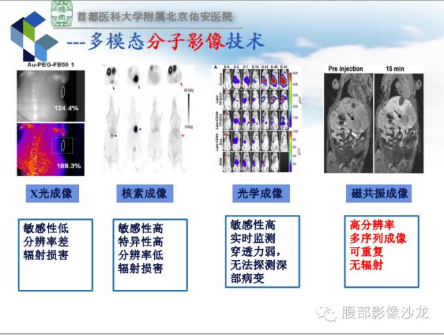 【PPT】HBV相关肝细胞癌演变MRI分级诊断