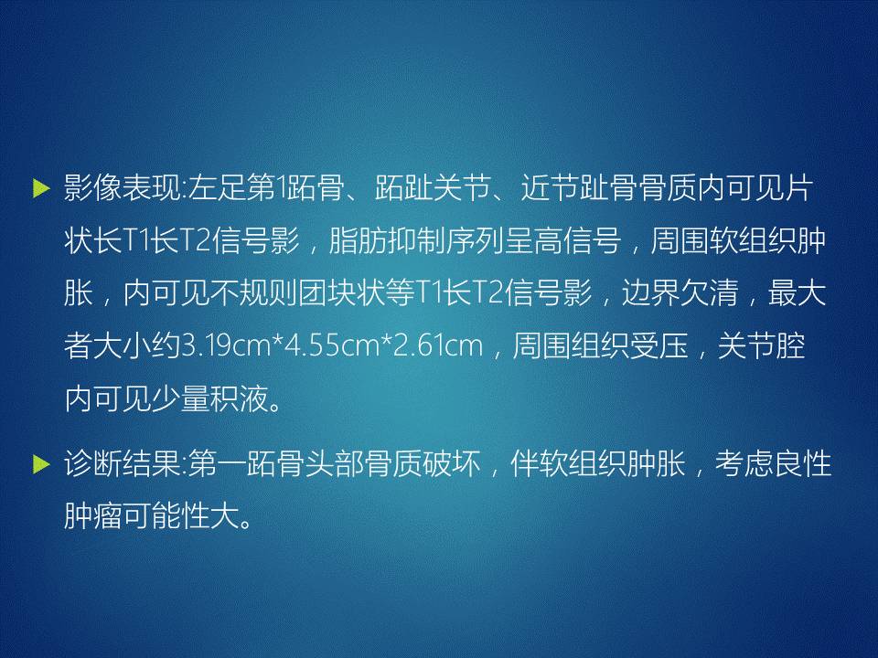 【病例】左足腱鞘巨细胞瘤1例CT及MR影像表现 【病例】左足腱鞘巨细胞瘤1例CT及MR影像表现