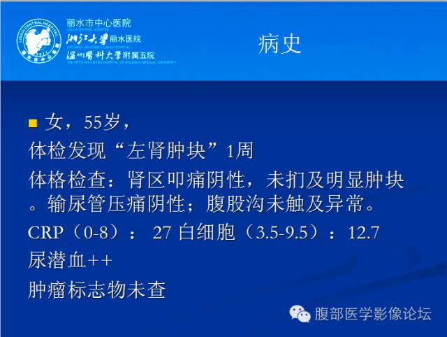 【病例】肾平滑肌瘤1例CT影像表现