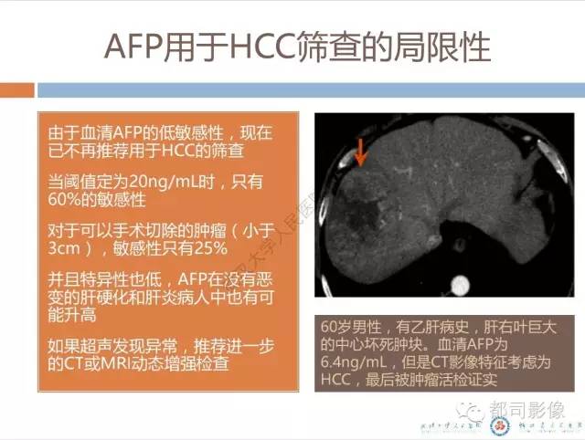 【PPT】放射科医生应知道的常用腹盆部肿瘤标记物