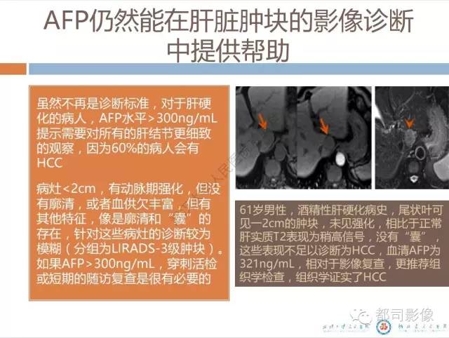 【PPT】放射科医生应知道的常用腹盆部肿瘤标记物