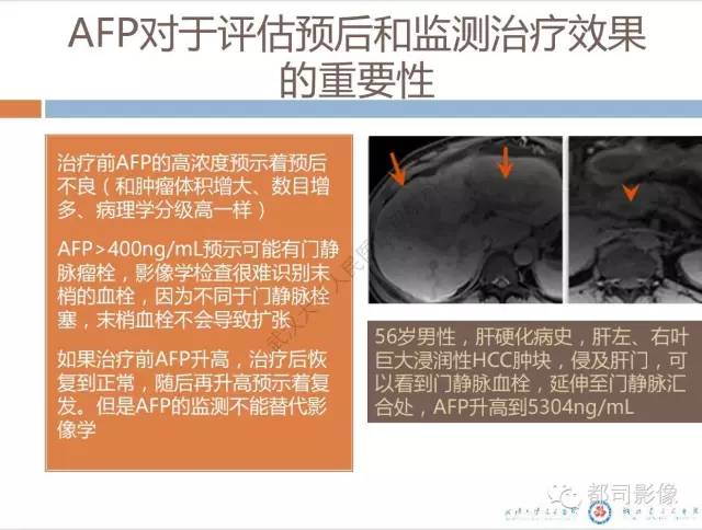 【PPT】放射科医生应知道的常用腹盆部肿瘤标记物