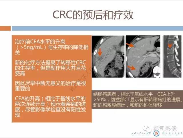 【PPT】放射科医生应知道的常用腹盆部肿瘤标记物