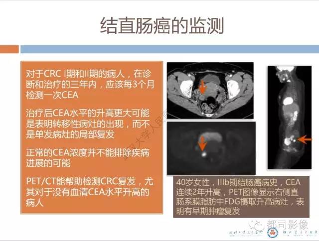 【PPT】放射科医生应知道的常用腹盆部肿瘤标记物