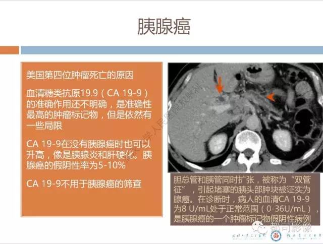【PPT】放射科医生应知道的常用腹盆部肿瘤标记物
