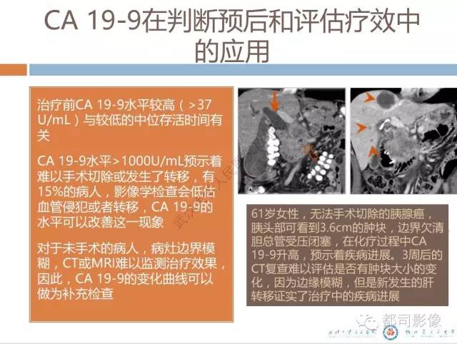 【PPT】放射科医生应知道的常用腹盆部肿瘤标记物
