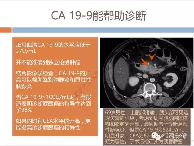 【PPT】放射科医生应知道的常用腹盆部肿瘤标记物