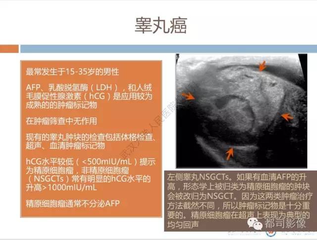 【PPT】放射科医生应知道的常用腹盆部肿瘤标记物