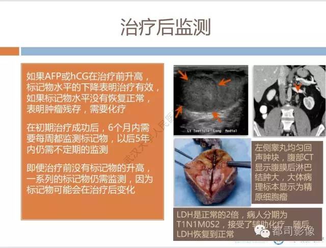【PPT】放射科医生应知道的常用腹盆部肿瘤标记物