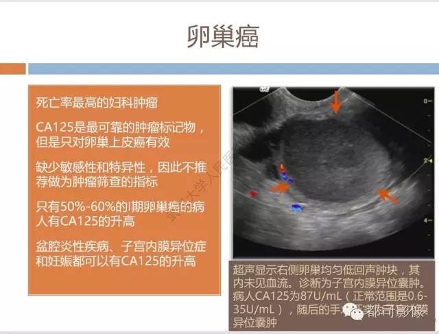 【PPT】放射科医生应知道的常用腹盆部肿瘤标记物