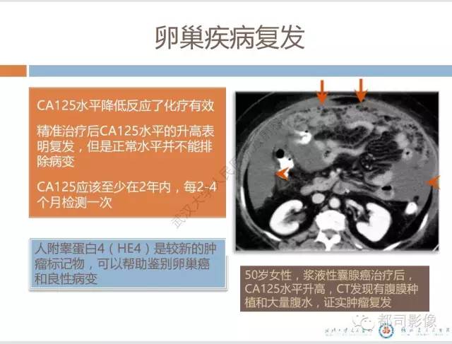 【PPT】放射科医生应知道的常用腹盆部肿瘤标记物