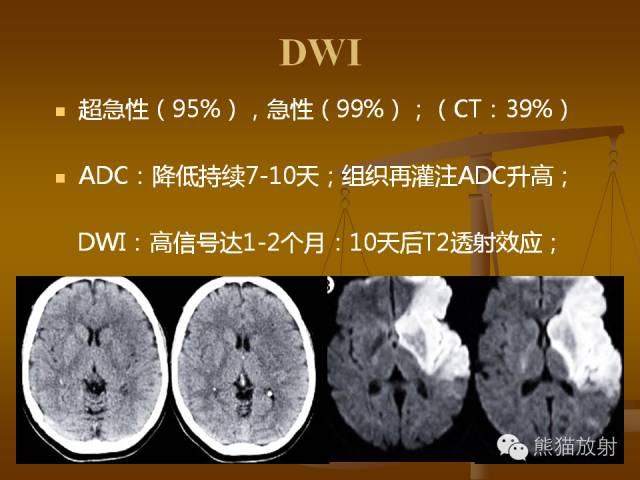 【PPT】脑梗死及相关改变MRI表现