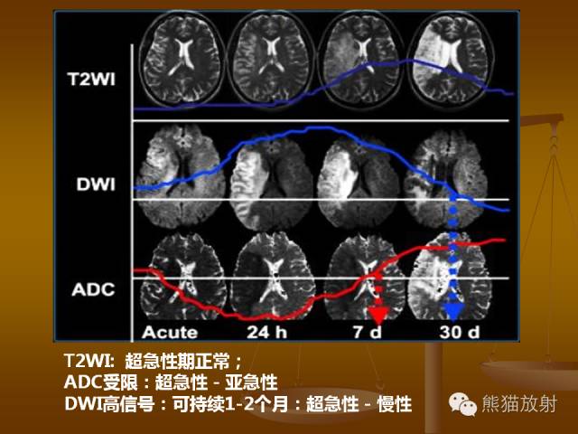 【PPT】脑梗死及相关改变MRI表现