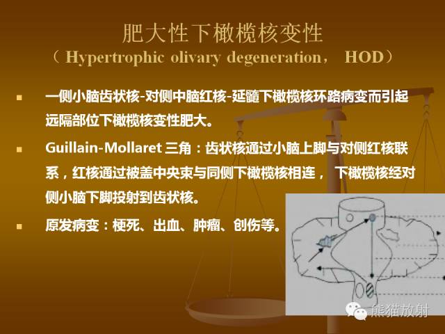 【PPT】脑梗死及相关改变MRI表现