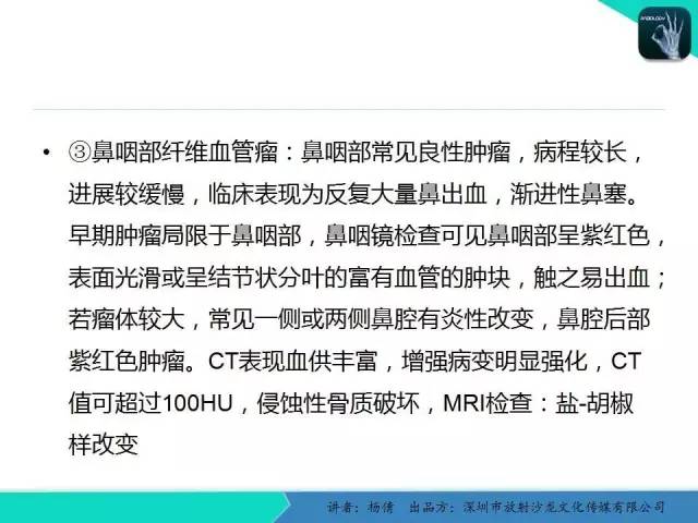 【病例】鼻咽部淋巴组织增生性炎症1例CT及MR