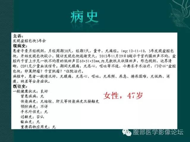 【病例】腹膜后神经鞘瘤1例MR影像表现
