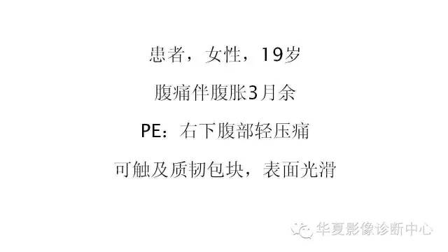 【病例】腹膜后淋巴瘤1例CT影像表现