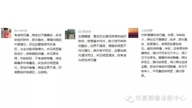 【病例】腹膜后淋巴瘤1例CT影像表现