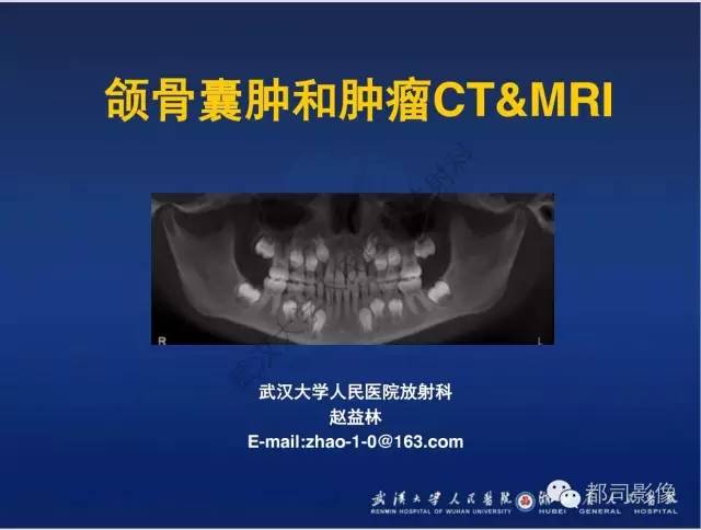 【PPT】颌骨囊肿和肿瘤CT&MRI
