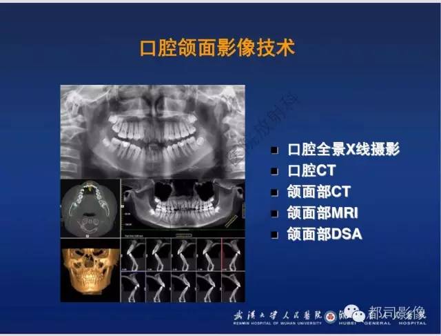 【PPT】颌骨囊肿和肿瘤CT&MRI