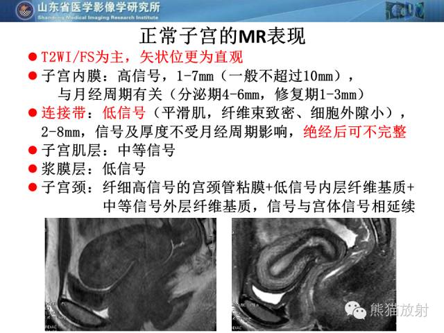 【PPT】盆腔影像检查技术及诊断的培训要点