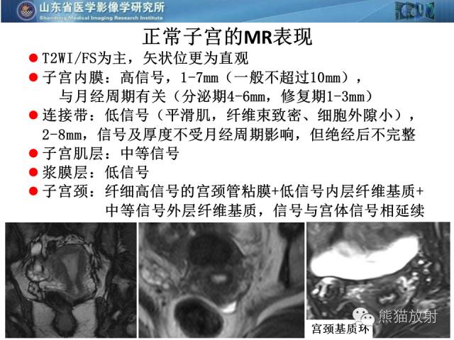 【PPT】盆腔影像检查技术及诊断的培训要点