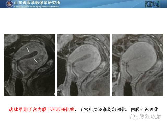【PPT】盆腔影像检查技术及诊断的培训要点