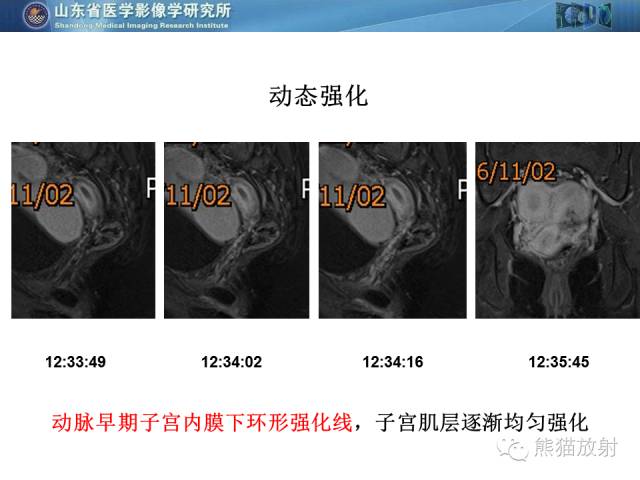 【PPT】盆腔影像检查技术及诊断的培训要点
