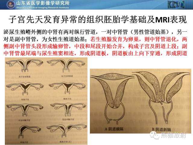 【PPT】盆腔影像检查技术及诊断的培训要点