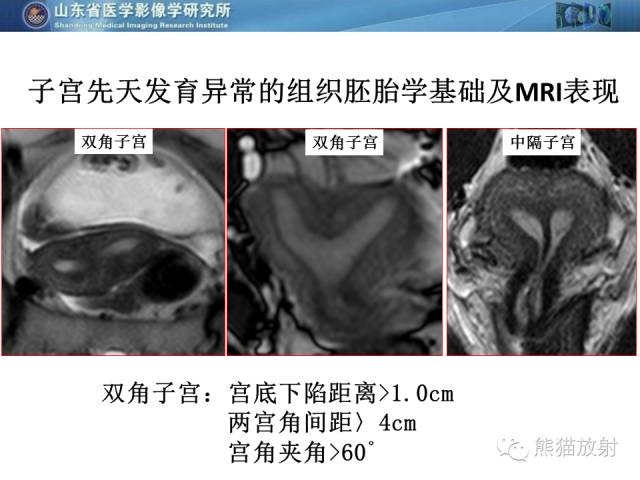 【PPT】盆腔影像检查技术及诊断的培训要点