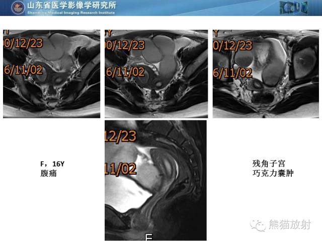 【PPT】盆腔影像检查技术及诊断的培训要点