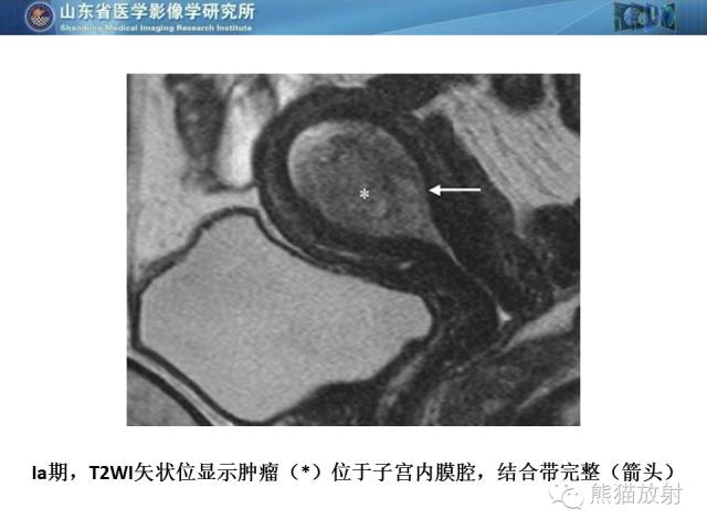 【PPT】盆腔影像检查技术及诊断的培训要点