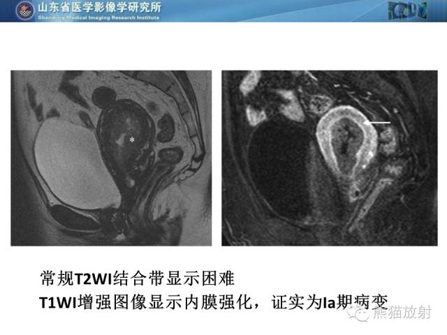 【PPT】盆腔影像检查技术及诊断的培训要点