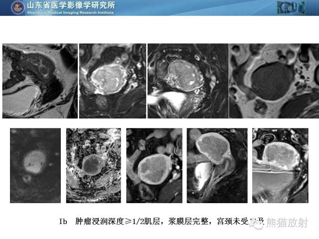 【PPT】盆腔影像检查技术及诊断的培训要点