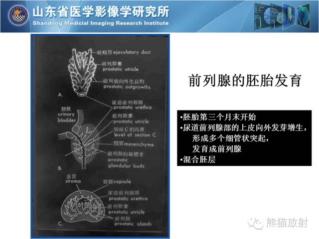 【PPT】盆腔影像检查技术及诊断的培训要点