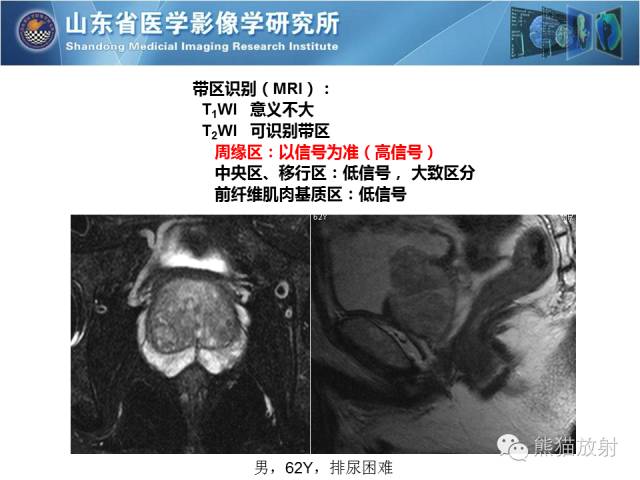 【PPT】盆腔影像检查技术及诊断的培训要点