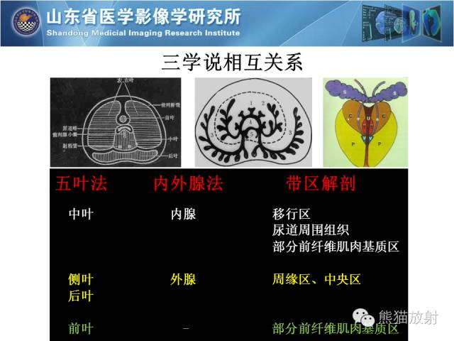 【PPT】盆腔影像检查技术及诊断的培训要点