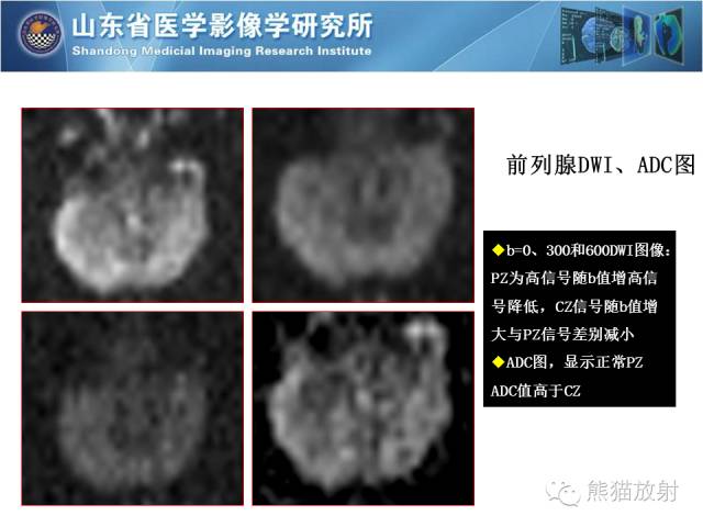 【PPT】盆腔影像检查技术及诊断的培训要点