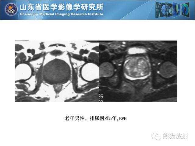 【PPT】盆腔影像检查技术及诊断的培训要点